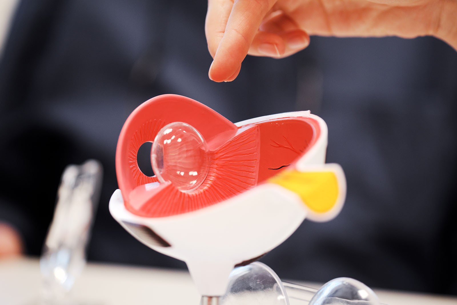 Grauer-Star-1600 Das Bild zeigt ein plastisches Schaubild des Auges